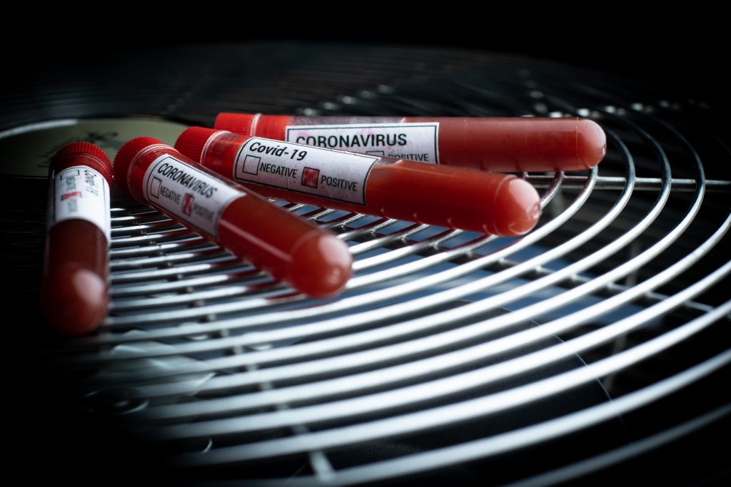 Coronavirus-blutproben-expagroder